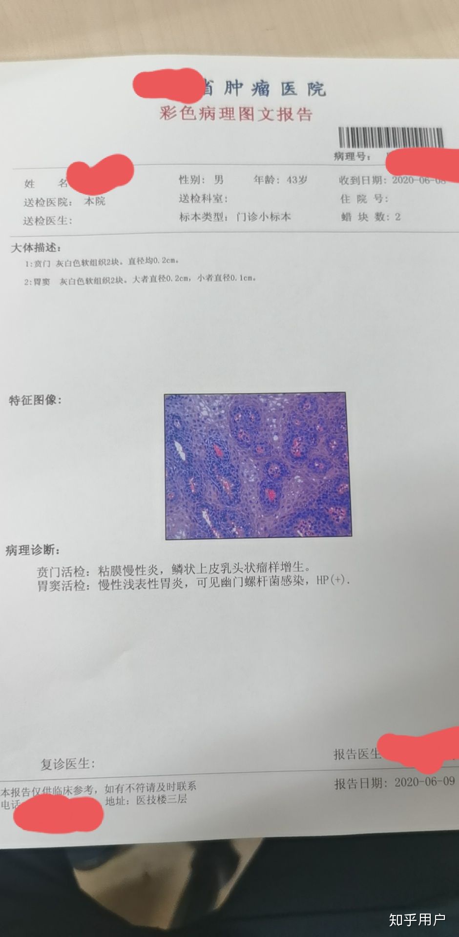 E79CA759-07D5-4CE3-AC2A-F93ED74CFECC.jpeg E79CA759-07D5-4CE3-AC2A-F93ED74CFECC.jpeg
