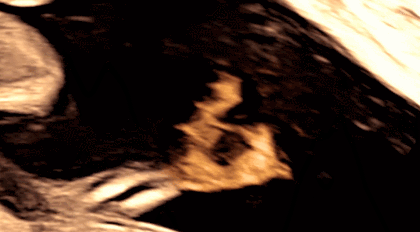 54.gif