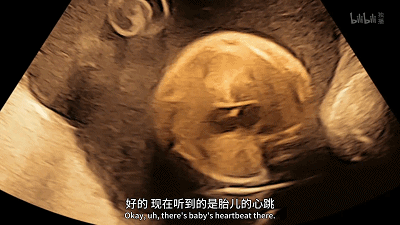 69.gif